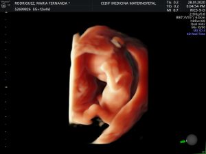 Centro de Diagnóstico Integral Fetal CEDIF