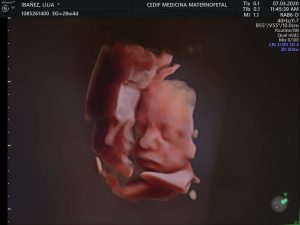 Centro de Diagnóstico Integral Fetal CEDIF
