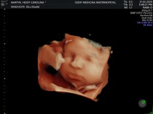 Centro de Diagnóstico Integral Fetal CEDIF